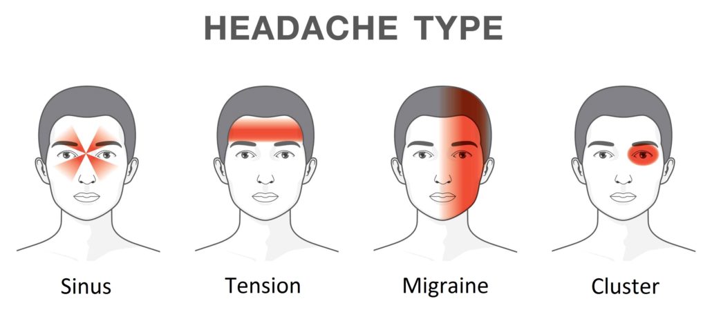 types of headaches and location